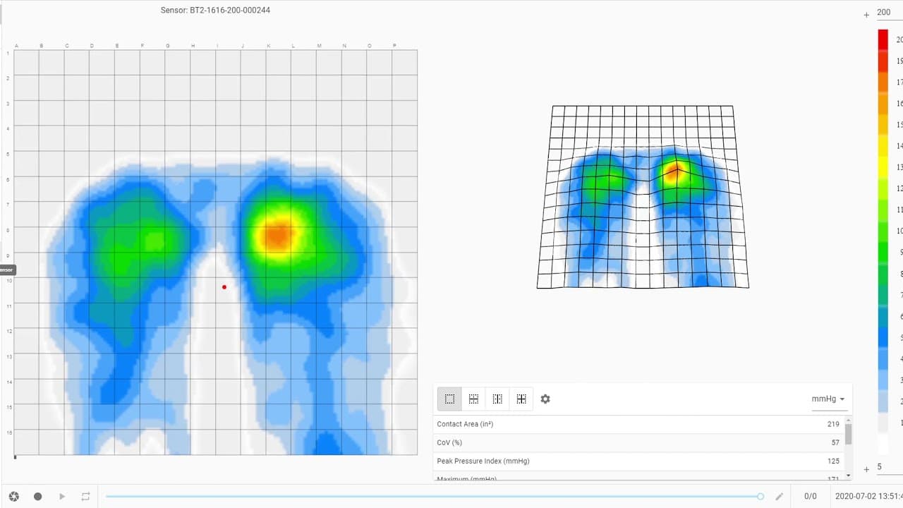 BodiTrak pressure mapping equipment used during seating assessment